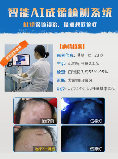 7-治疗白癜风多快好省,先得专业仪器确诊.jpg